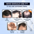 Who should use it? If you are suffering from: Hair Thinning, Reduced Hair Volume, Increased Scalp Visibility, Excessive Hair fall, Excessive Breakage.